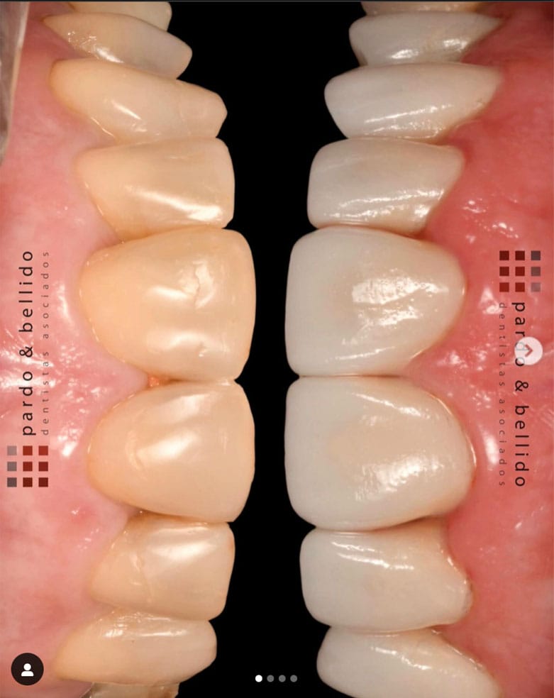 Odontología Estética y Restauradora