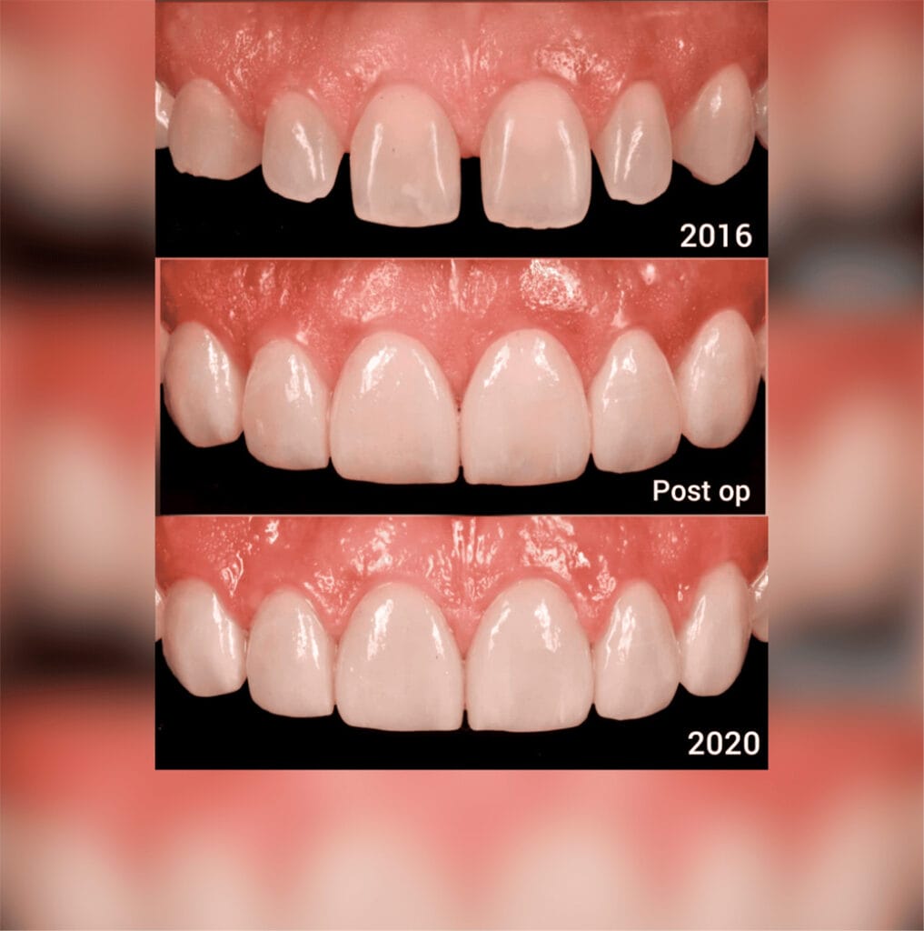 Rehabilitación Oral