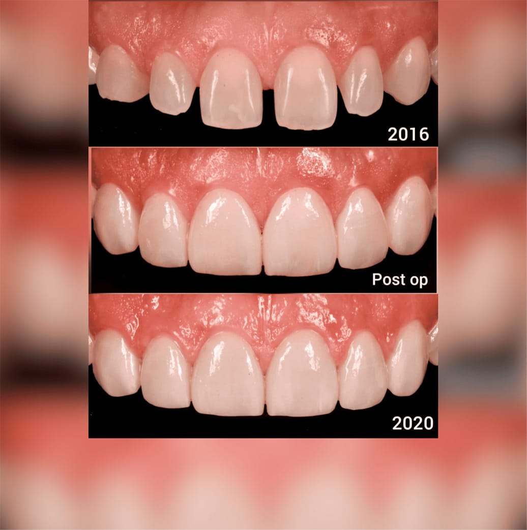 Rehabilitación Oral